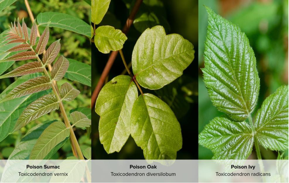 Contact Dermatitis from Poison Ivy, Oak or Sumac - Mercy Urgent Care